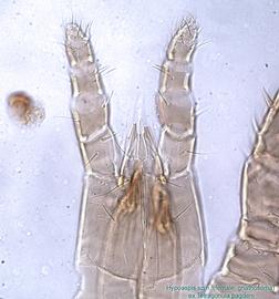  Fig. 15.  Hypoaspis  sp.n. (ex  Tetragonula pagdeni ) female ventral gnathosoma; DIC. 