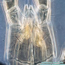  Fig. 16.  Hypoaspis  sp.n. (ex  Tetragonula pagdeni ) female ventral gnathosoma; phase contrast. 