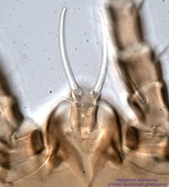  Fig. 19.  Histiostoma conclavicola  phoretic deutonymph gnathosoma. 