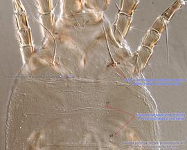  Fig. 2.  Suidasia pontifica  female prodorsum and anterior hysterosoma. 