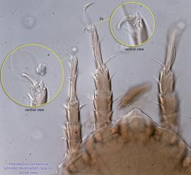  Fig. 21.  Histiostoma conclavicola  phoretic deutonymph legs I-II. 