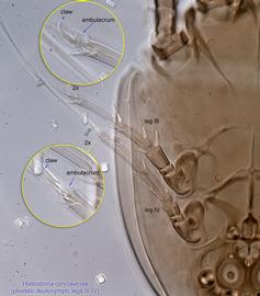  Fig. 22.  Histiostoma conclavicola  phoretic deutonymph legs III-IV. 