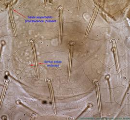  Fig. 3.  Cosmolaelaps vacuus  female posterior hysterosoma showing dorsal setae. 