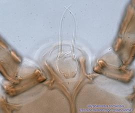  Fig. 3.  Glyphanoetus nomiensis  phoretic deutonymph gnathosoma. 