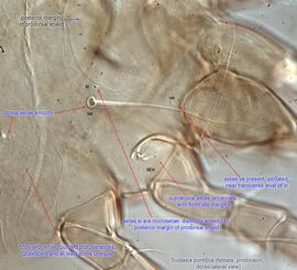  Fig. 3.  Suidasia pontifica  female prodorsum, dorso-lateral view. 