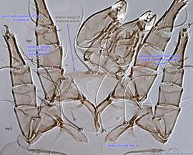  Fig. 3.  Tyrolichus casei  female prodorsum. 
