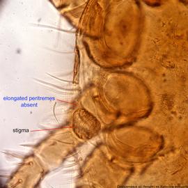  Fig. 4.  Dinogamasus  sp. (ex  Xylocopa aestuans ) female stigma. 