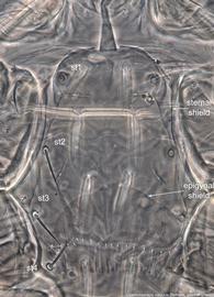  Fig. 4.  Cosmolaelaps vacuus  female sternal shield. 