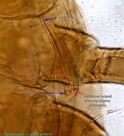  Fig. 4.  Trigonholaspis  sp. n. female peritreme. 