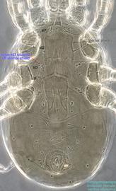  Fig. 5.  Afrocypholaelaps lindquisti  female idiosoma, ventral view; phase contrast. 