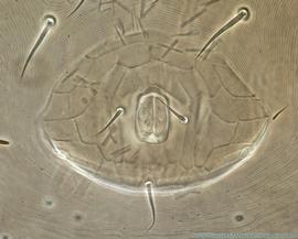  Fig. 5.  Neocypholaelaps  sp. female anal shield. 