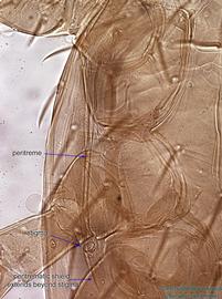  Fig. 6.  Cosmolaelaps vacuus  female peritreme. 