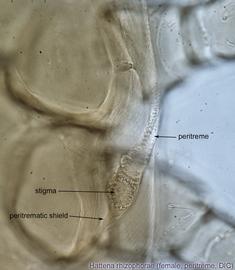  Fig. 6.  Hattena rhizophorae  female peritreme; DIC. 