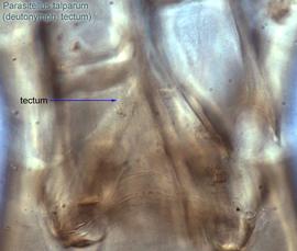  Fig. 6.  Parasitellus talparum  deutonymph anterodorsal gnathosoma showing tectum. 