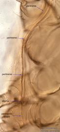  Fig. 6.  Stratiolaelaps  sp. female peritreme. 