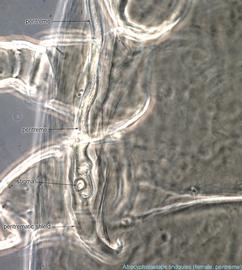  Fig. 7.  Afrocypholaelaps lindquisti  female peritreme. 