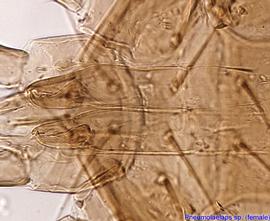  Fig. 7.  Pneumolaelaps  sp. (ex  Bombus crotchii;  CA) female chelicerae, lateral view. 