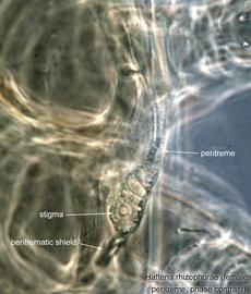  Fig. 7.  Hattena rhizophorae  female peritreme; phase contrast. 