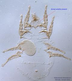  Fig. 7.  Histiostoma feroniarum  female, dorsal view. 