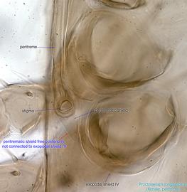  Fig. 8.  Proctolaelaps   longisetosus  female peritreme. 