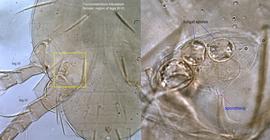  Fig. 8.  Trochometridium tribulatum  female sporotheca (right) and its location in region near coxae III and IV (left); both images are optical sections close to ventral side. 