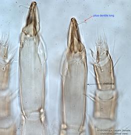  Fig. 9.  Androlaelaps casalis  female chelicerae, ventral view. 