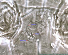  Fig. 9.  Cosmolaelaps vacuus  female spermatheca. 